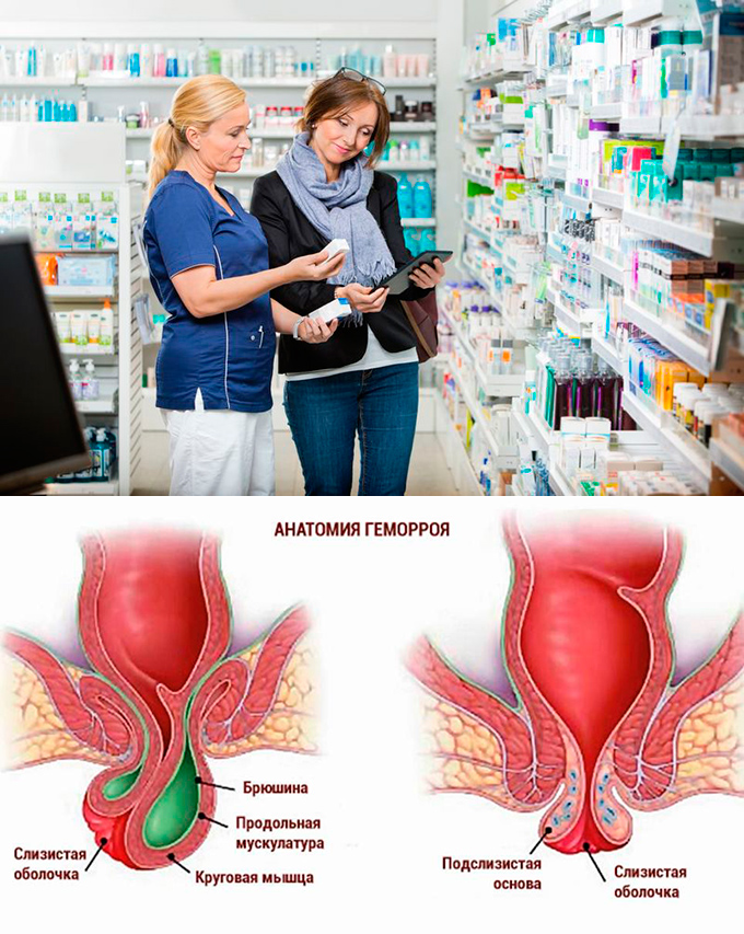 Геморрой домашнее лечение отзывы. Геморрой у женщин наружного.