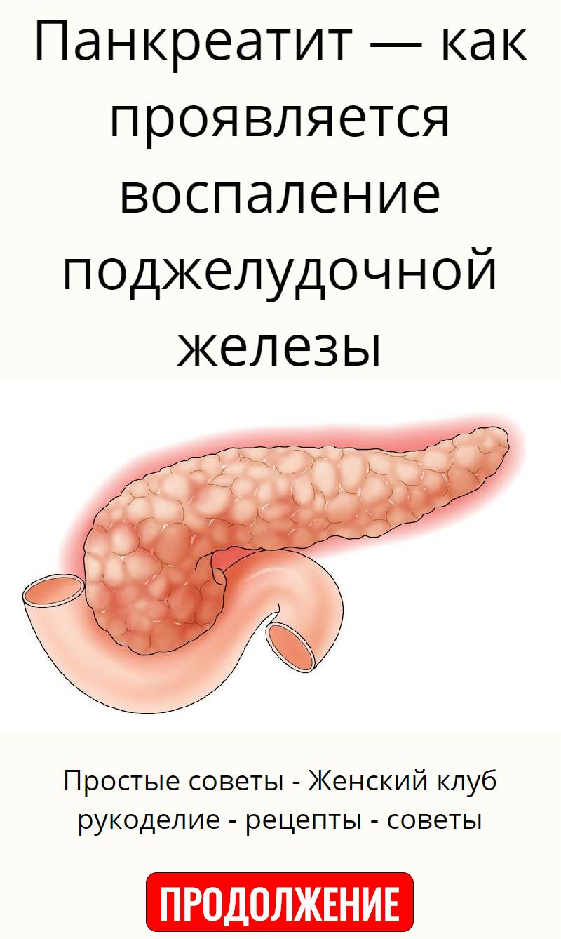 Воспаление поджелудочной железы симптомы. Воспаление поджелудочной. Панкреатит поджелудочной железы.