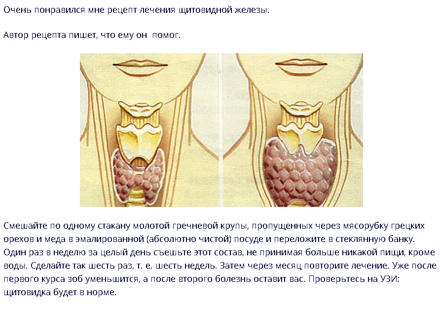 Щитовидная восстановилась. Диета при щитовидной железы. Питание при щитовидных узлах. Диета при проблемах с щитовидной железой. Диета при узлах на щитовидке.