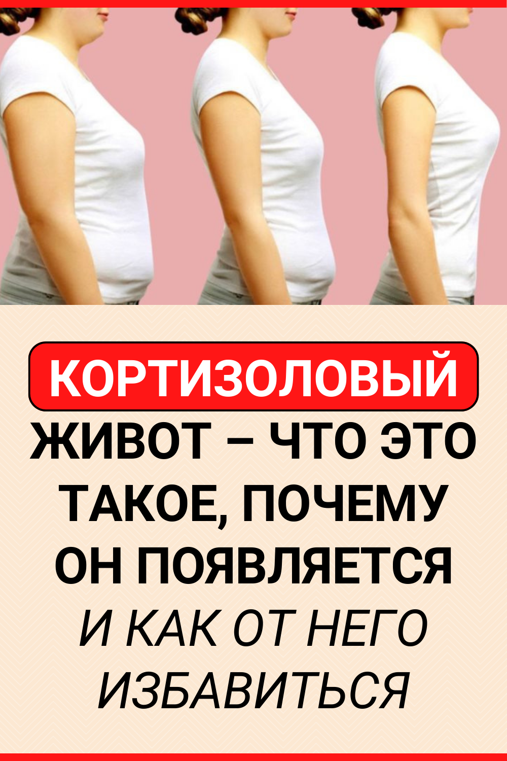 Кортизоловый живот