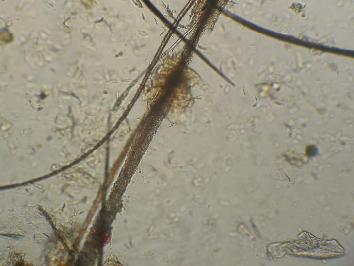 На коже обнаружены споры. Микроспория под микроскопом у кошек. Микроспория микроскопия.