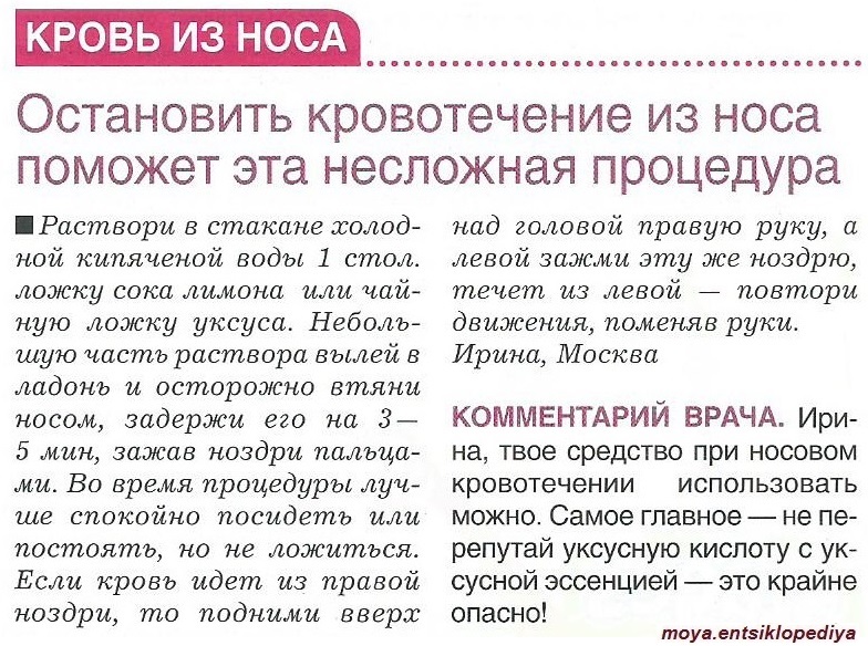 Остановить носовое кровотечение в домашних. Какгстановить кровь из носа. Какочтановить кровь из носа. Акае Остановить кровь из носа. Как Остановить кровь из но а.