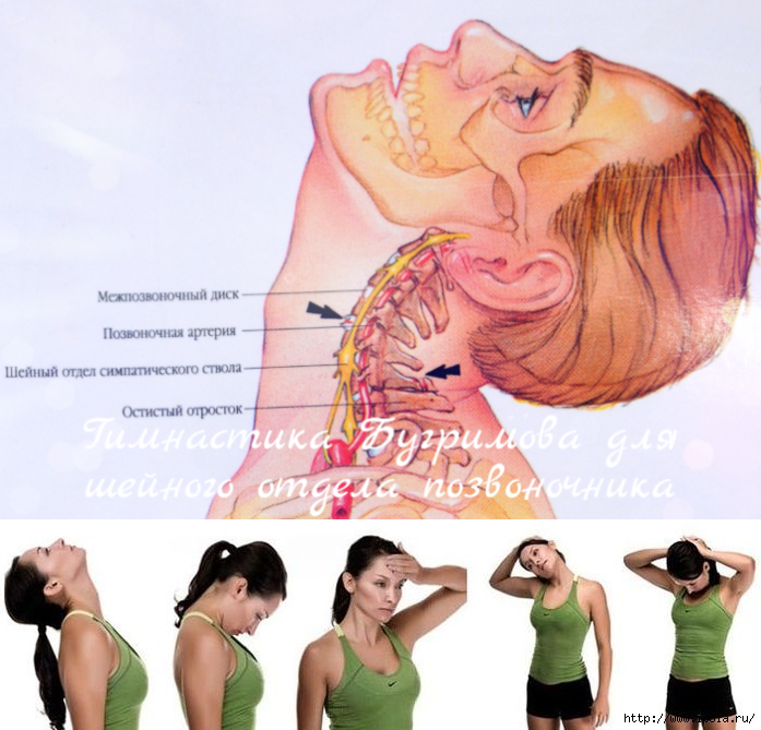 Прогревание позвоночника. Симптомы остеохондроза шейного отдела позвоночника. Продуло шею. Остеохондроз шейного отдела симптомы. Можно ли при шейном остеохондрозе греть шею.