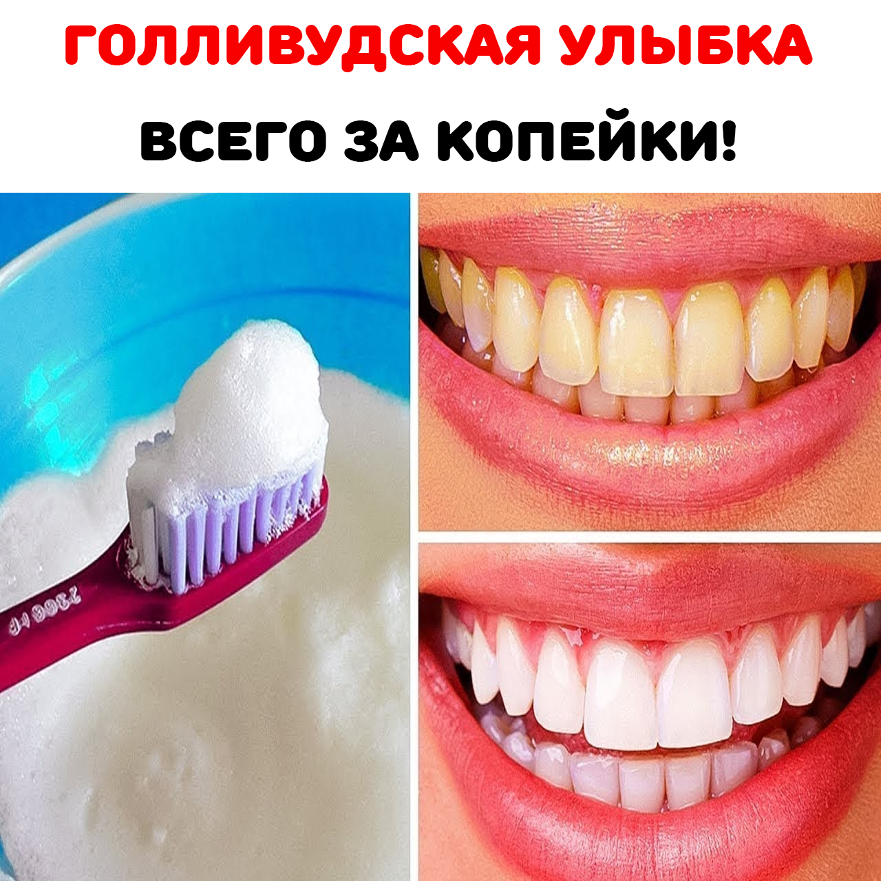 Рецепт отбеливания зубов. Смесь отбеливающая зубы. Отбеливание зубов в домашних условиях без вреда для эмали и зубов. Отбелить зубы в домашних условиях без вреда. Отбеливание зубов содой.