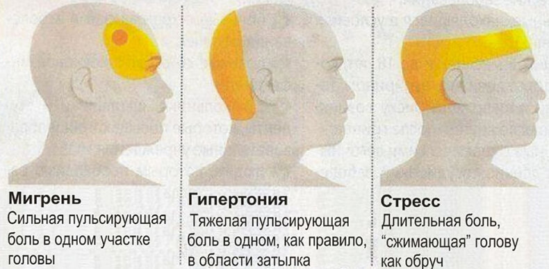 Почему болит голова в затылочной части головы? | Всегда в форме ...
