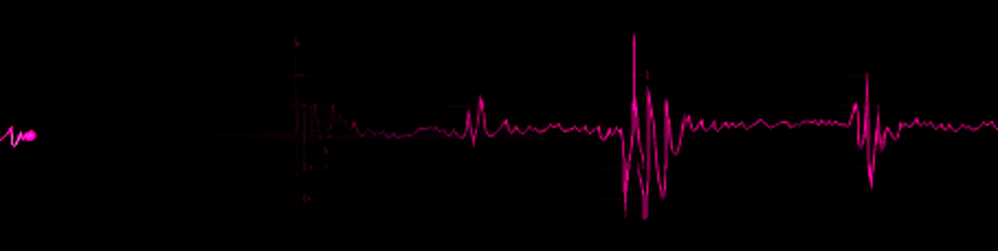 Сердцебиения 23. Пульс анимация. Биение сердца на черном фоне. Пульс гифка. Кардиограмма остановки сердца.