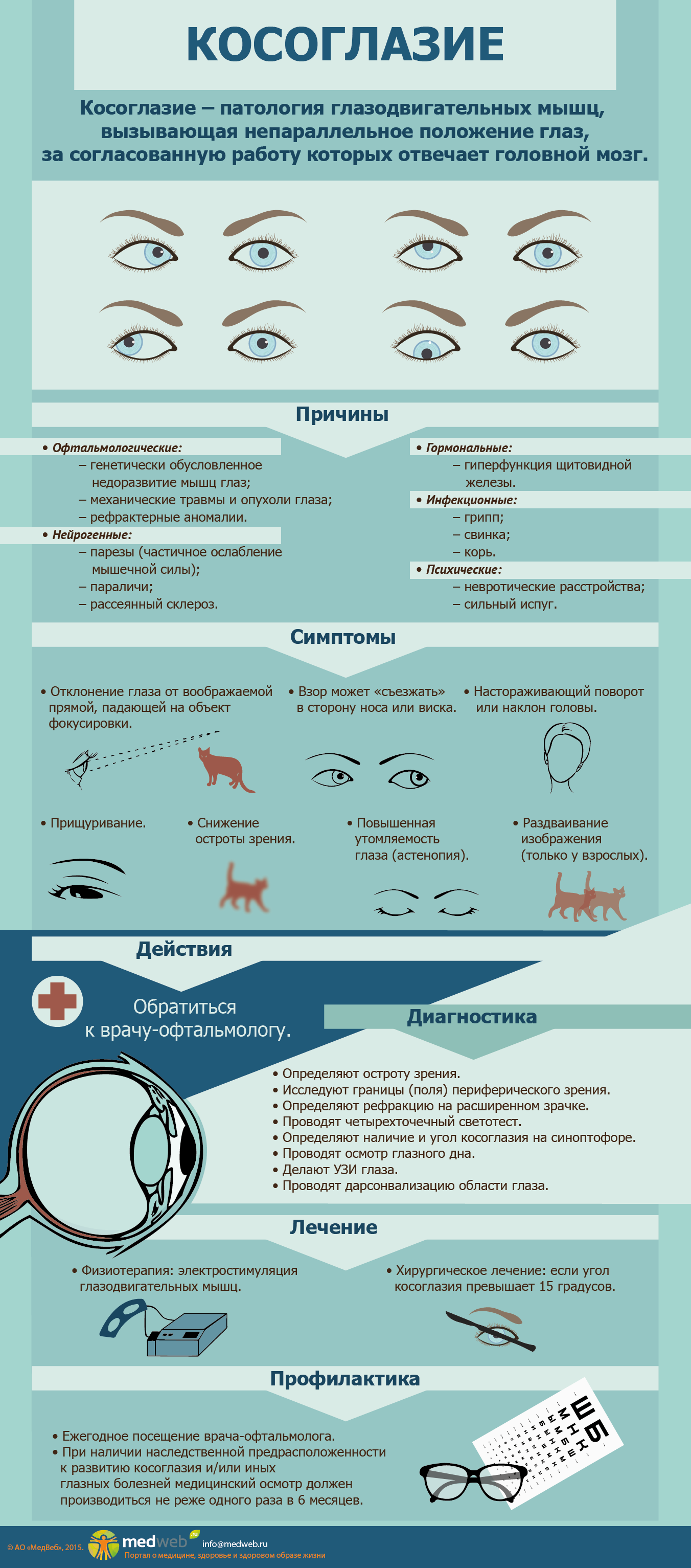 Косоглазие симптомы. Таблица заболевания глаз косоглазие. Косоглазие причины возникновения. Инфографика заболевания глаз. Профилактика косоглазия.