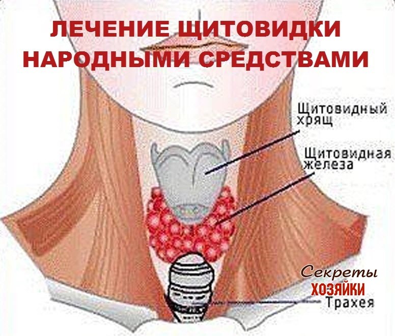 Народное лечение узлов щитовидной железы. Терапия щитовидной железы. Щитовидная железа лечится. Излечение щитовидной железы.
