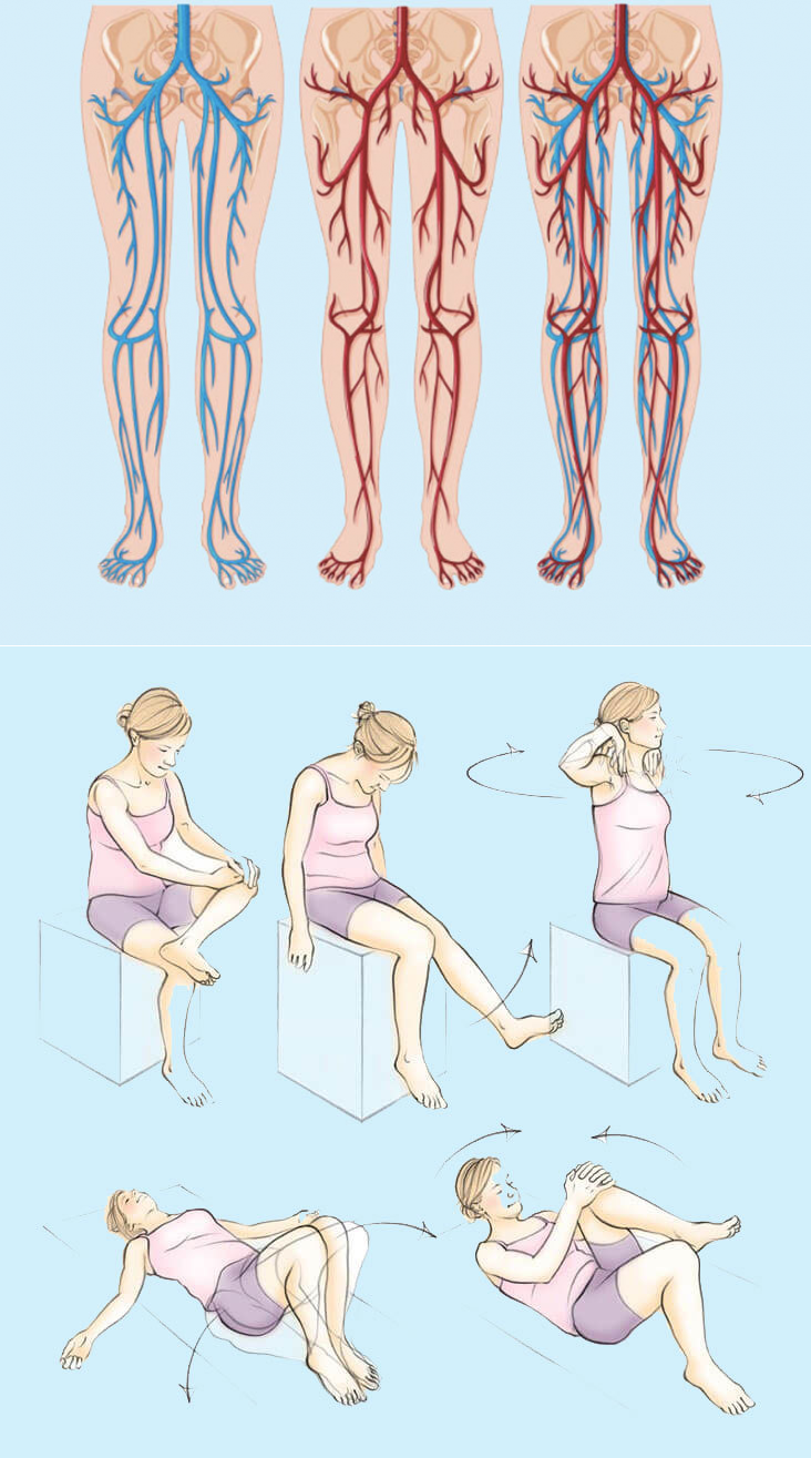 Упражнения от отеков. Варикозное расширение вен гимнастика. Упражнения при варикозе. Упражнения от варикозного расширения. Упражнения для ног при варикозе.