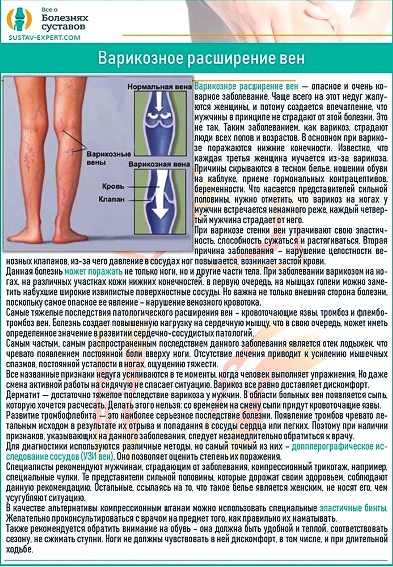 Горят ноги ступни у мужчин причины. Варикозная болезнь вен нижних конечностей факторы. Варикозная болезнь вен нижних конечностей по степени. Варикозное расширение вен нижних конечностей профилактика. Варикозное расширение вен голеней профилактика.