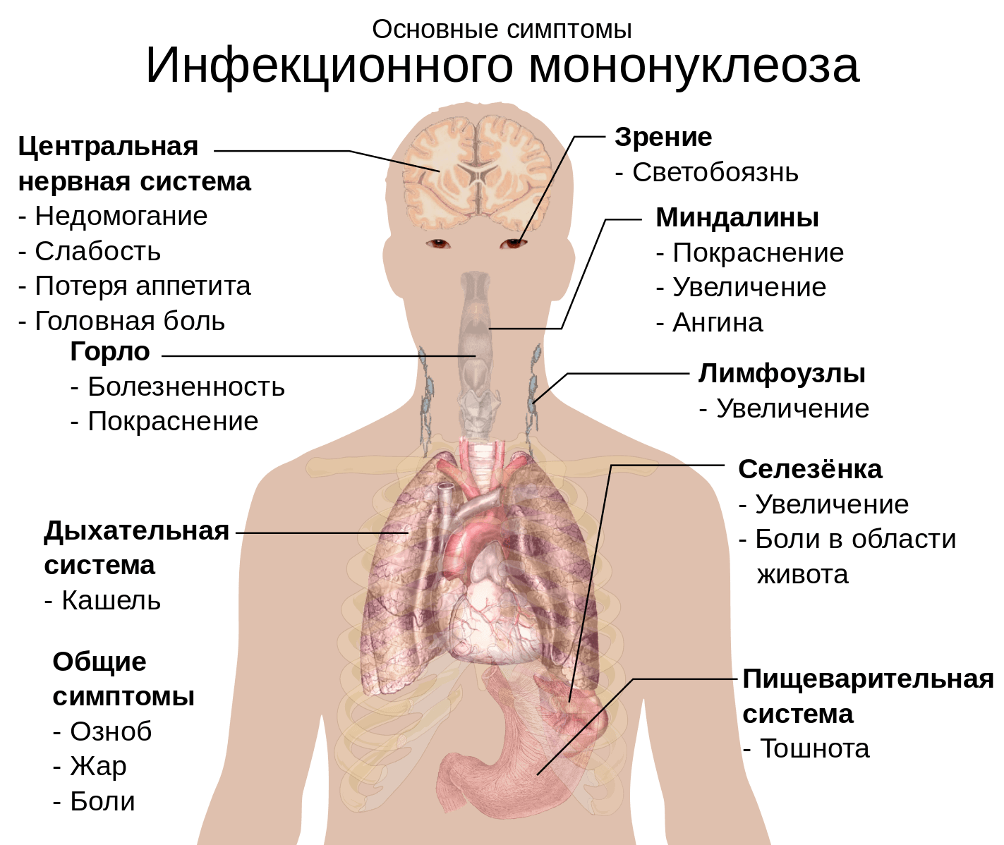 Инфекционный мононуклеоз симптомы