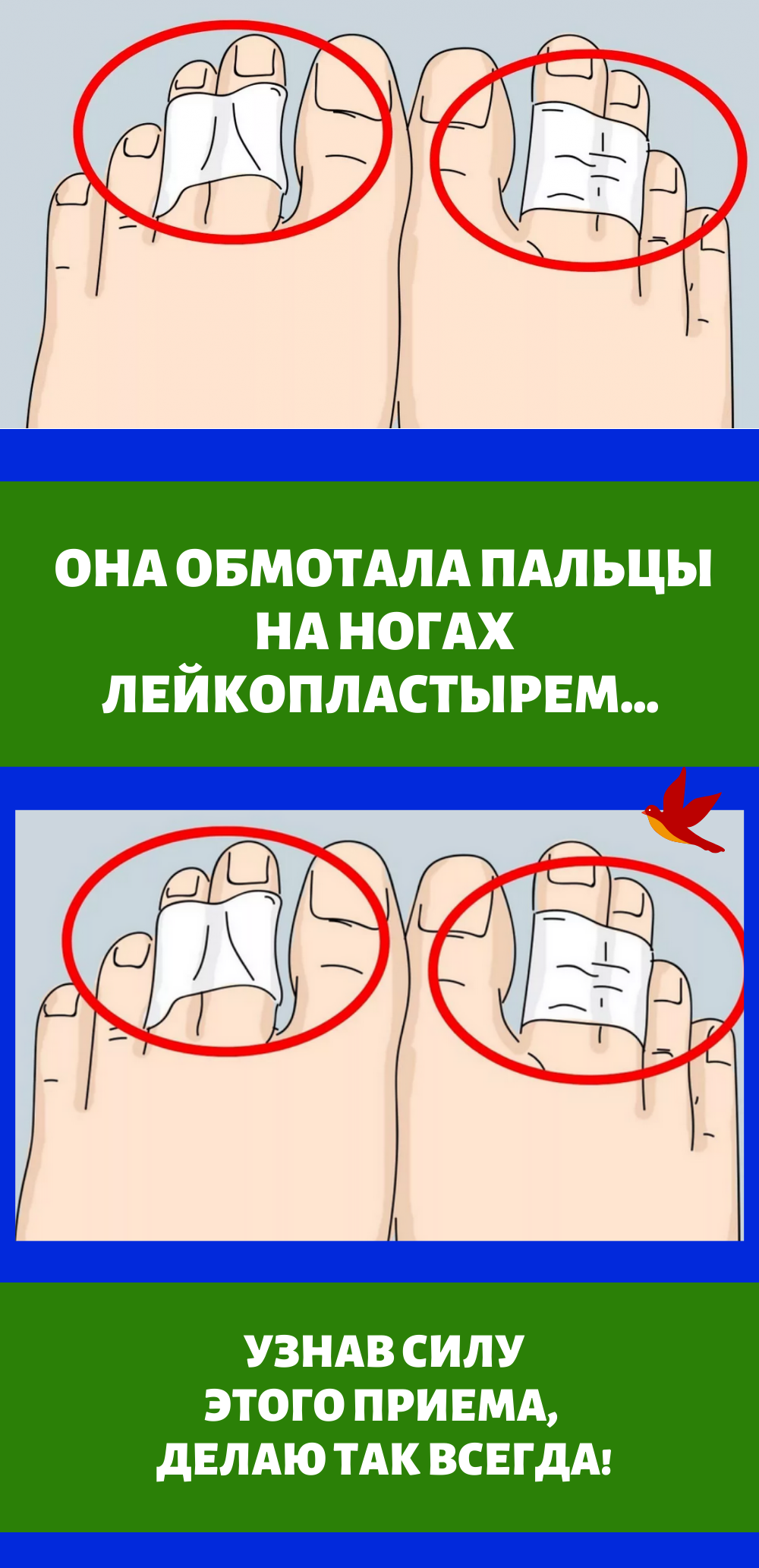 Она обмотала пальцы на ногах лейкопластырем. Узнав силу этого приема ...