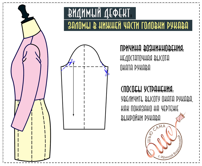 Устранение дефектов рукавов. Дефекты посадки рукава. Мюллер и сын исправление дефектов посадки. Дефекты посадки рукава и их устранение склада спереди. Мюллер и сын исправление дефектов посадки.