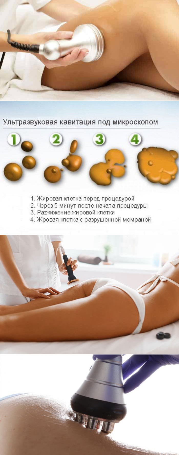 Ультразвуковая кавитация