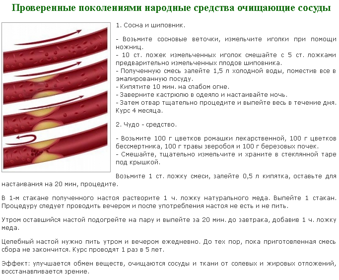 Почистить сосуды от холестерина в домашних условиях. Чистка артерий и сосудов. Чистка сосудов народными средствами. Чистка сосудов хвоей. Как можно почистить сосуды.