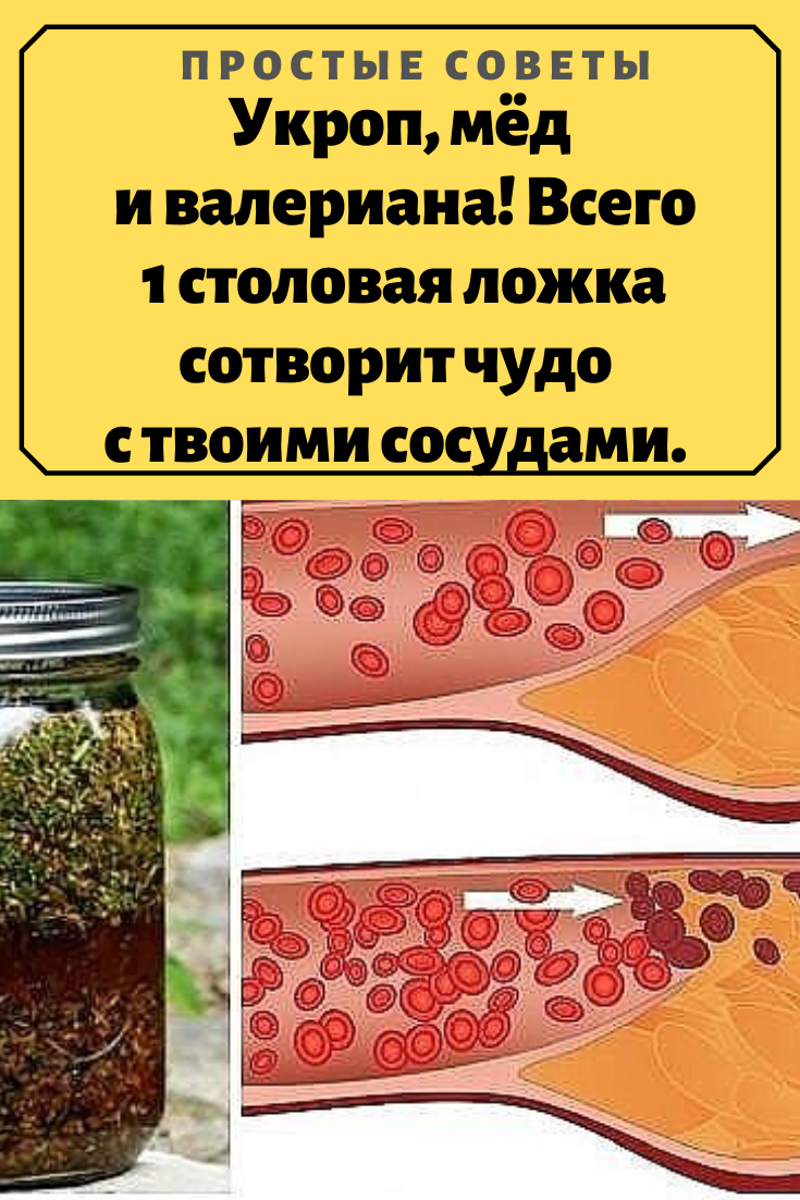Чистка сосудов укропом. Чистка сосудов с укропным семенем. Печень очистится мгновенно. Чистка сосудов укропом. Укроп, мёд и валериана.