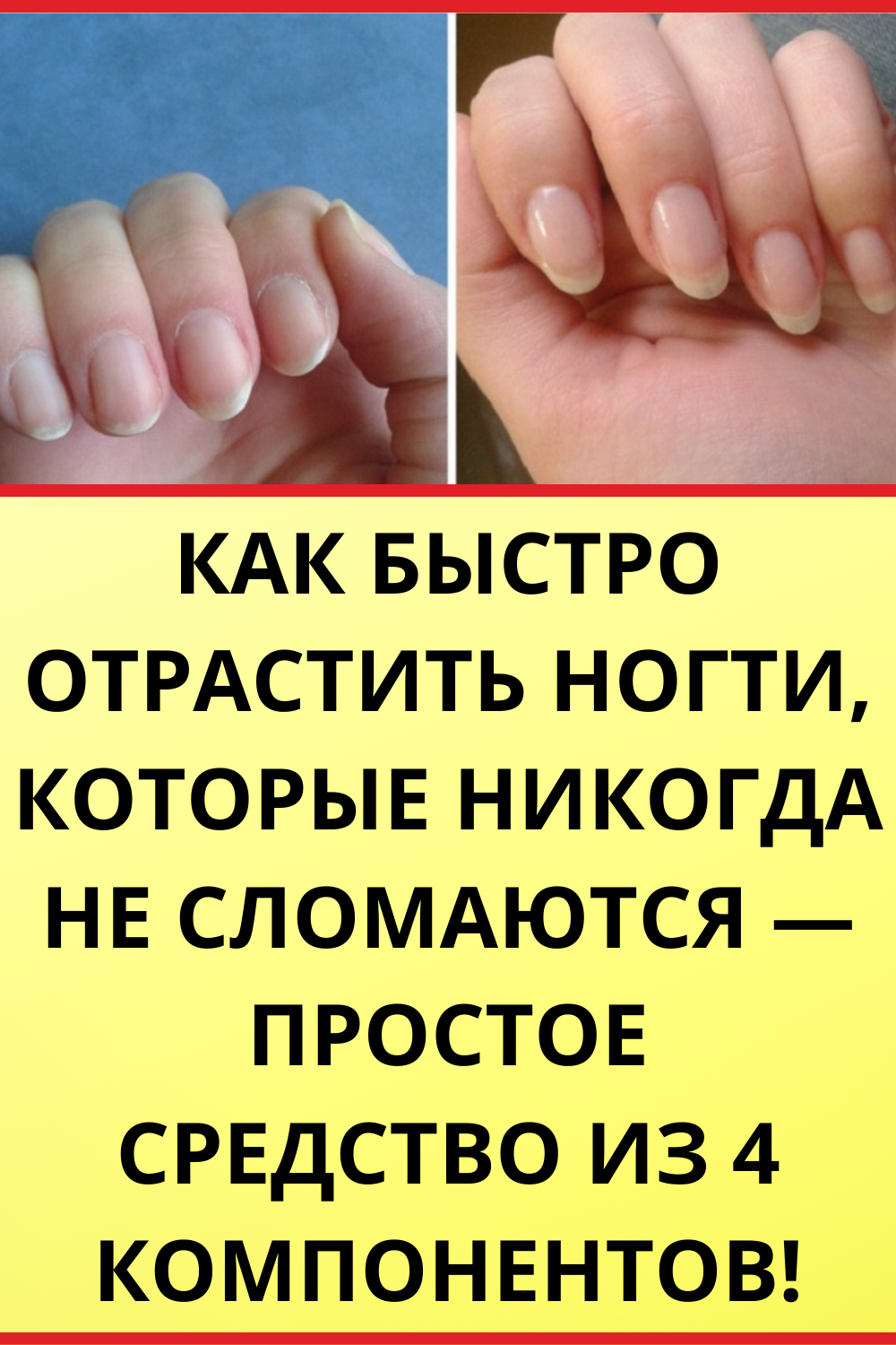 Как быстро отрастить ногти, которые никогда не сломаются — простое ср ...