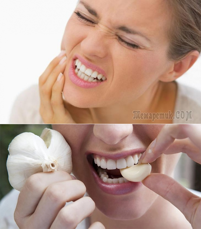 Зубная боль лечение в домашних условиях. Болит зуб. Примочки для зубов.