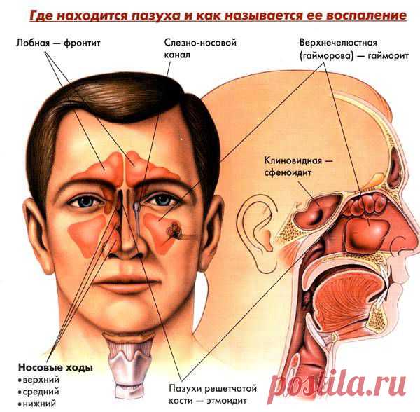 Как быстро избавиться от насморка и кашля.