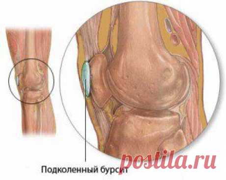 Причины и лечение боли в коленях