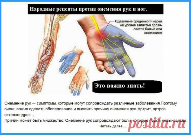 Народные средства против онемения рук и ног.