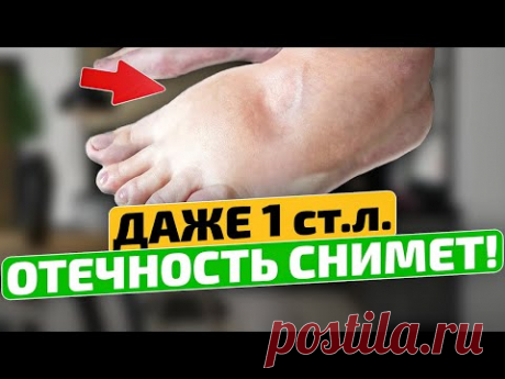 Старый доктор спас меня этим советом! Как избавиться от отеков ног.