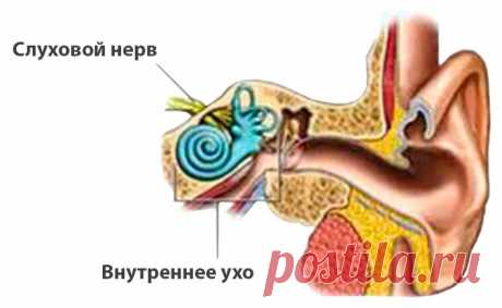Неврит слухового нерва. Лечение неврита слухового нерва народными средствами | Народная медицина