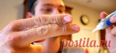 Простой и эффективный способ очистить пальцы от суперклея