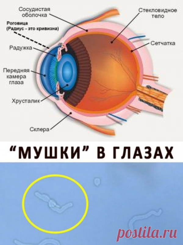 Плавающая черная точка в глазу что это. Murashki pered glazami. Мушки перед глазами. Стекловидное тело глаза мушки.
