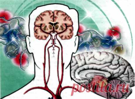 КАК ЛЕЧИТЬ народными средствами сужение сосудов головного мозга