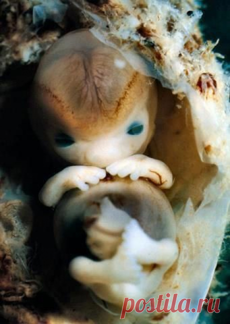 Я выживаю везде!: Эмбрион человека, 7 недель, размер 14 мм