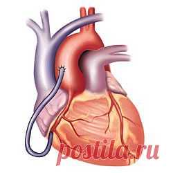 (+1) - 11 возможных признаков сердечного приступа | КРАСОТА И ЗДОРОВЬЕ