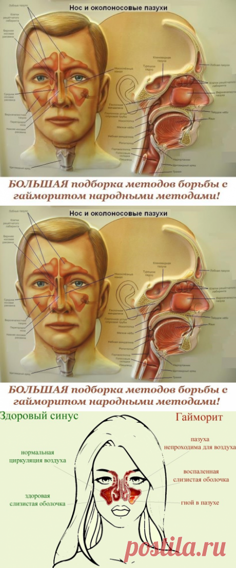 (38) Одноклассники