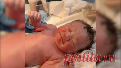 Жажда жизни: малыш родился со спиралью от беременности в руке. Фото уже стало вирусным!