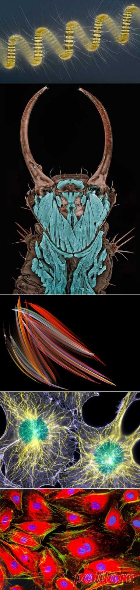 Лучшие фото под микроскопом за последние 40 лет - Наука и жизнь