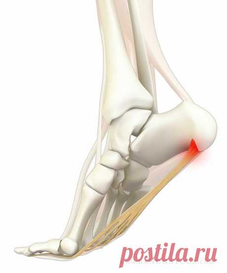 Пяточная шпора: что с ней делать?
Пяточной шпорой принято называть состояние, которое развилось из микротравмы подошвенной связки и приобрело хроническую форму. А «официальное» название этого заболевания – «плантарный фасциит». При нем образуется костная гипертрофия на связке, которая и становится источником боли для пациента. Участок такой гипертрофии называют остеофитом, и он действительно...
Читай пост далее на сайте. Жми ⏫ссылку выше