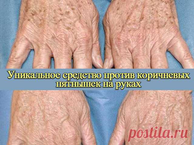 Как избавиться от пигментных пятен на руках и лице? 

Популярное мнение, что избавиться от веснушек и других пигментных 
пятен невозможно — прочно засело в головах современных людей. И хотя это утверждение устарело еще в начале 2000-х годов, большинство до сих пор верит, что для очищения кожи не существует способов. 

Но исследования в области очищения кожи от погментации не стоят на 
месте. Одно из недавних открытий врачей-дерматологов – крем Miracle Glow с китайским корд...