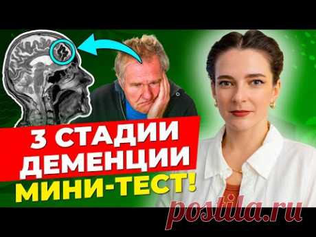 3 СТАДИИ ДЕМЕНЦИИ || Пройди ПРОСТОЙ ТЕСТ! Это должен знать каждый!