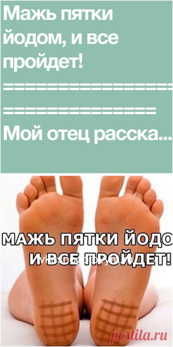 йодовая сетка на подошву ног. для чего мажут пятки йодом. зачем мазать пятки йодом. йодная сетка на пятках. зачем пятки мажут йодом на ночь.