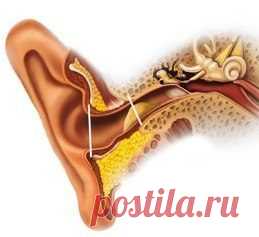 Серная пробка в ушах в ушах: удаление в домашних условиях / Будьте здоровы