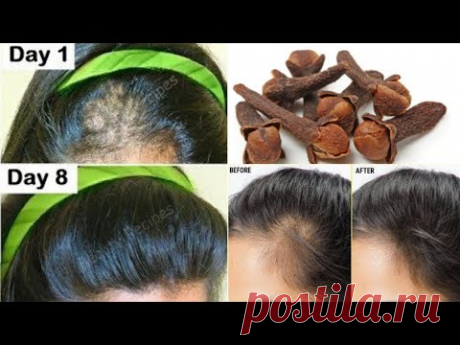 Индийский секрет,  🌱молниеносно отрастить волосы и лечить облысение в первую неделю