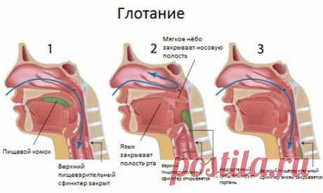 Как достать предмет из горла