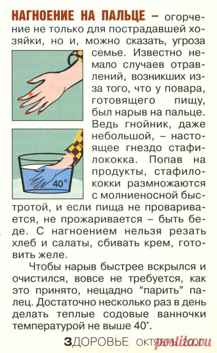 Нагноение на пальце