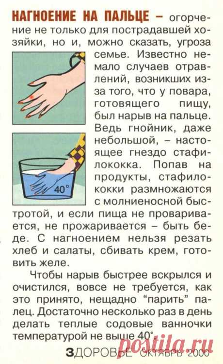 Нагноение на пальце