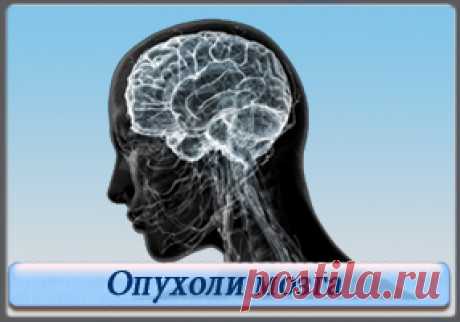 Опухоль головного мозга: симптомы должен знать каждый! 
Опухоль головного мозга – нестандартное разрастание мозговых клеток, как в пределах жизненно важного органа, так и по его оболочкам. 
Исходя из результатов клинических исследований, все опухоли можно…