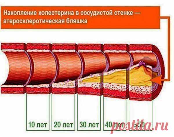 Проверенные поколениями народные средства для сосудов..