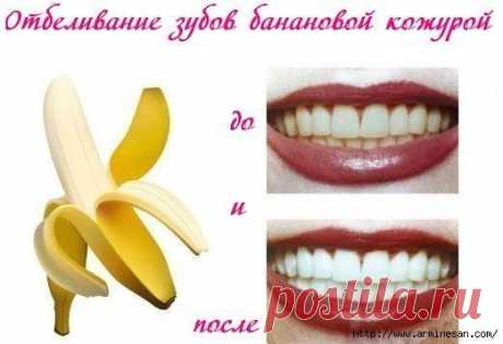 Отбеливание зубов банановой кожурой.