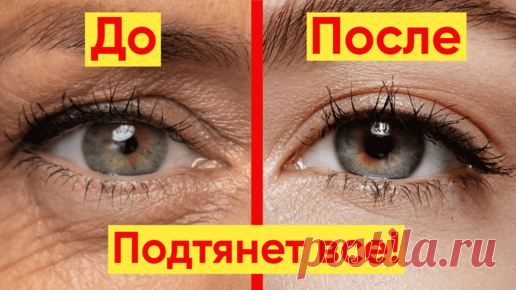 Мощный лифтинг комплекс для кожи вокруг глаз – подтянет нависшие веки | YKrasotka | Дзен