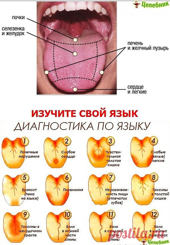 Рта диагноз