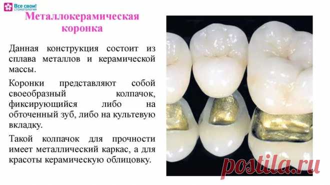 таблицы цен на съемные протезы из металлокерамики цена: 2 тыс изображений найдено в Яндекс Картинках